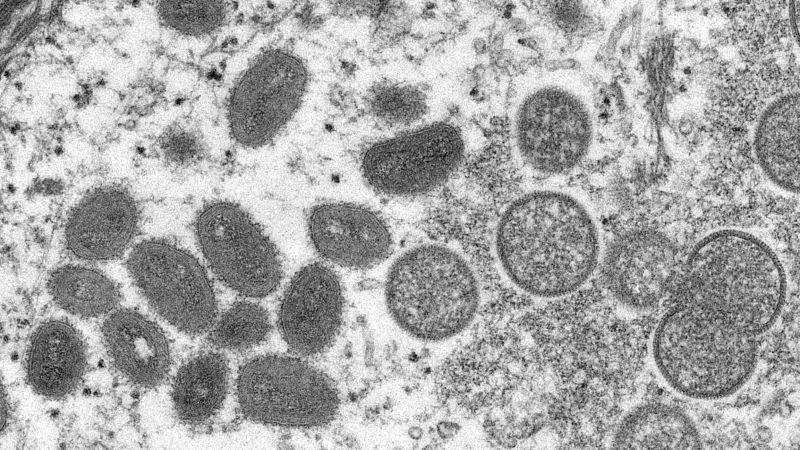 Six people who tested positive for monkeypox have died, health … – CNN