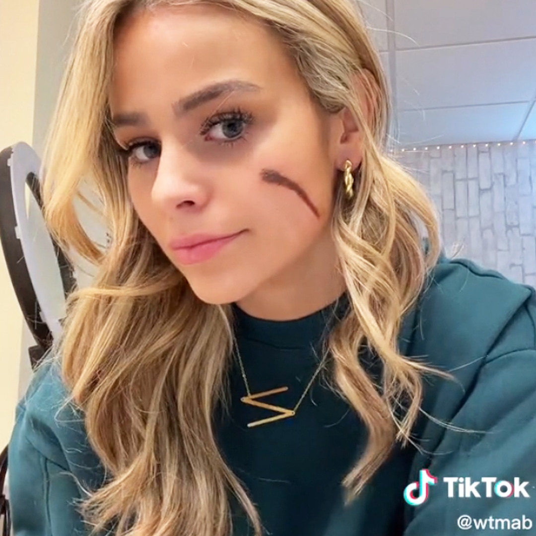 TikTok's "Scar Girl" Annie Bonelli Reacts to Claims Her Cheek Mark Is Fake – E! NEWS